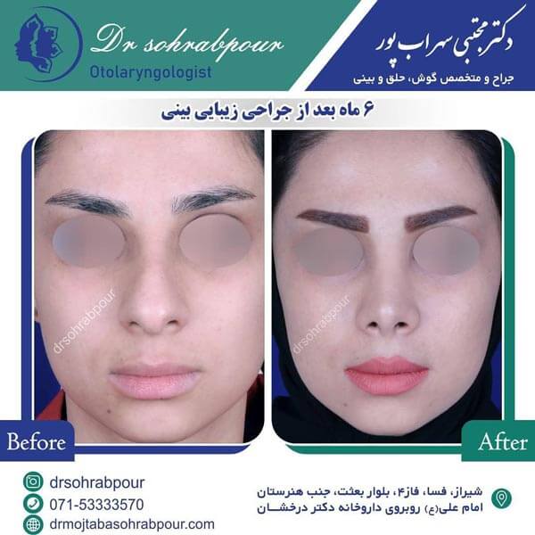 بهترین جراح بینی شیراز