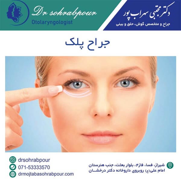 جراح پلک شیراز