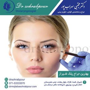 بهترین جراح پلک شیراز