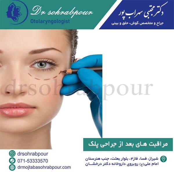 مراقبت های بعد از جراحی پلک