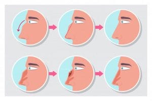 بهترین جراح بینی شیراز