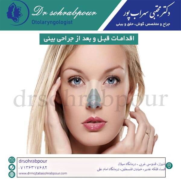 اقدامات قبل و بعد از جراحی بینی - دکتر مجتبی سهراب پور