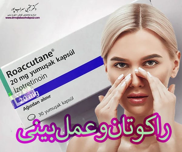 راکوتان و عمل بینی - دکتر مجتبی سهراب پور