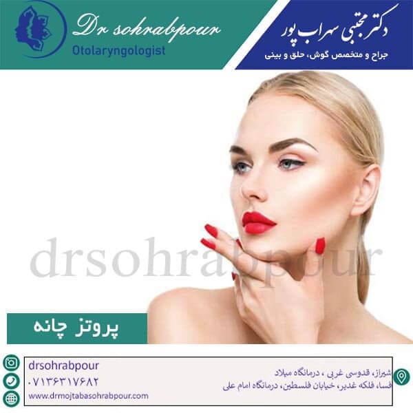 پروتز چانه - دکتر مجتبی سهراب پور