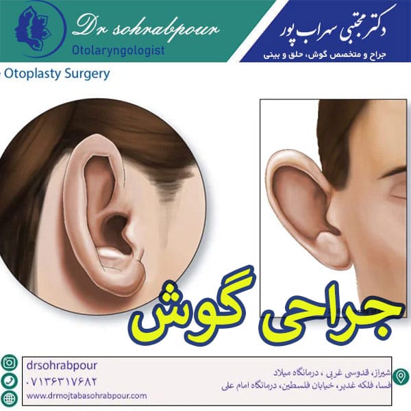 جراحی گوش - دکتر مجتبی سهراب پور