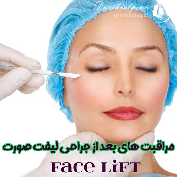مراقبت های بعد از جراحی لیفت صورت - دکتر مجتبی سهراب پور