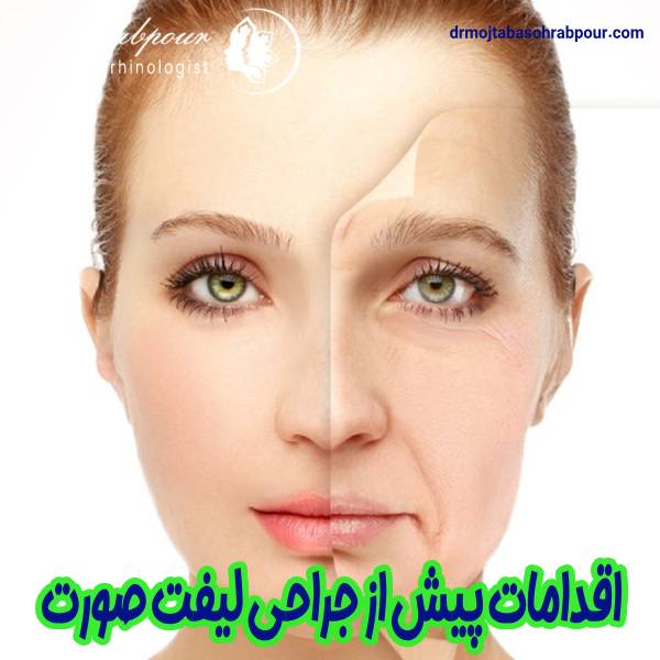 اقدامات قبل از لیفت صورت -