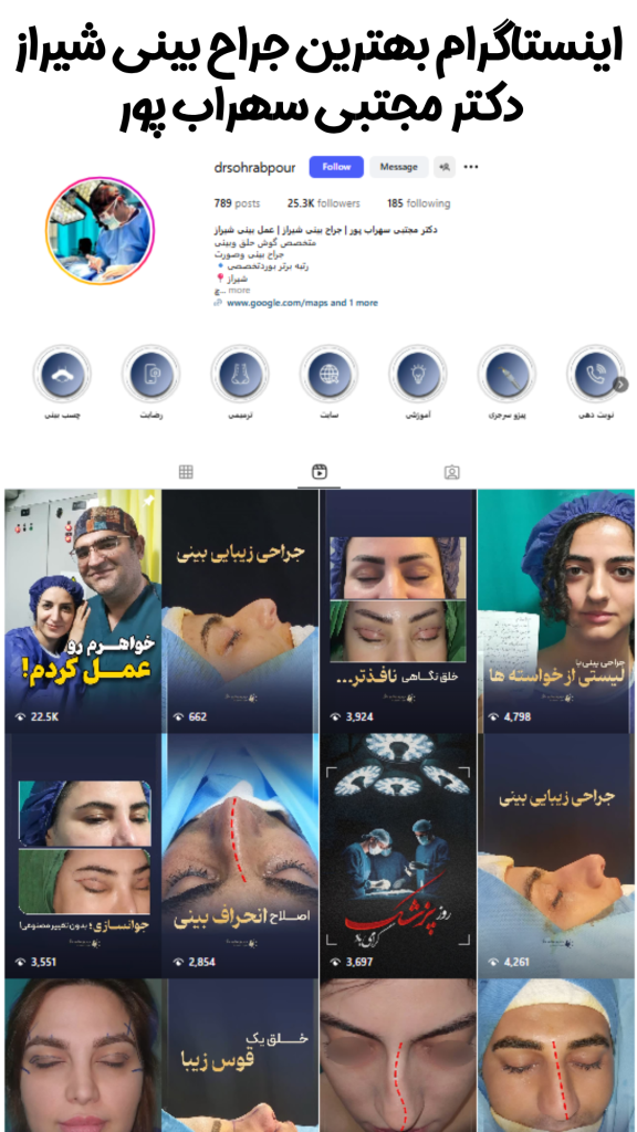 اینستاگرام بهترین جراح بینی شیراز - دکتر مجتبی سهراب پور