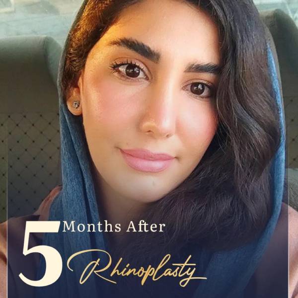 نمونه کار بهترین جراح بینی شیراز - دکتر مجتبی سهراب پور