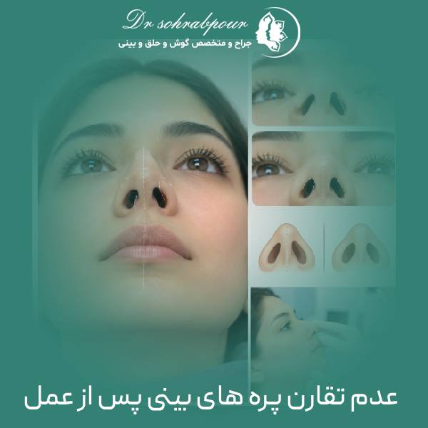 عدم تقارن پره های بینی بعد از جراحی