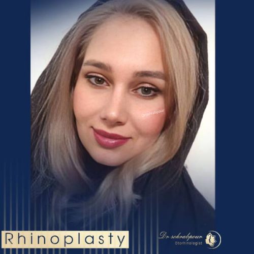 rhinoplasty-247