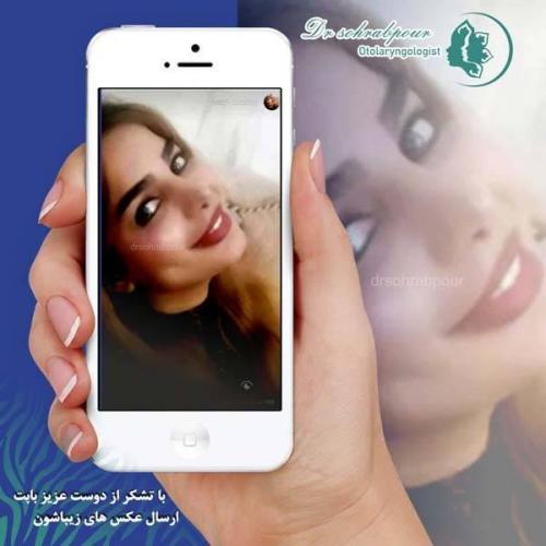 جراحی-بینی-135