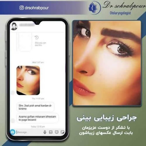 جراحی-بینی-185