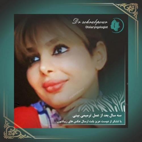 جراحی-زیبایی-بینی-1