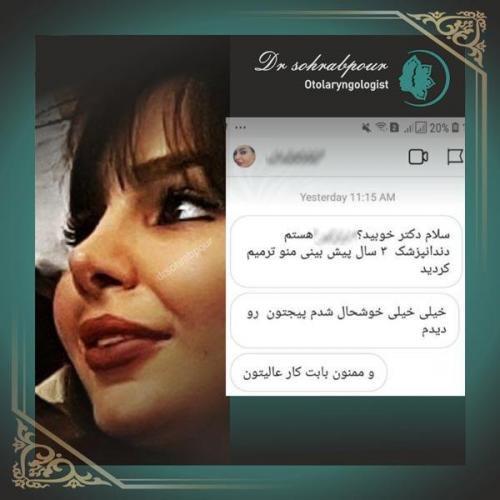 جراحی-زیبایی-بینی-2