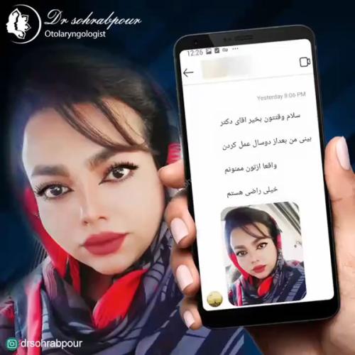 جراحی-بینی-در-شیراز188